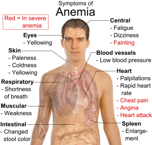 Symptoms_of_anemia